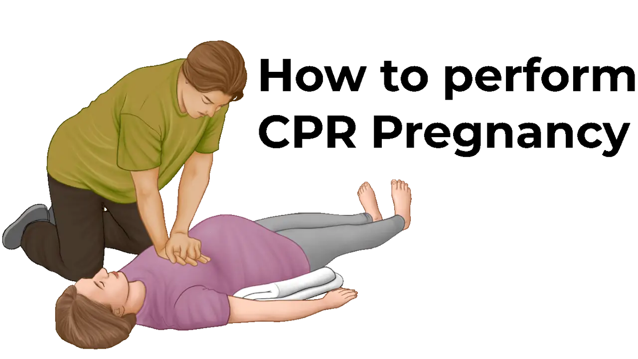 How to perform CPR Pregnancy