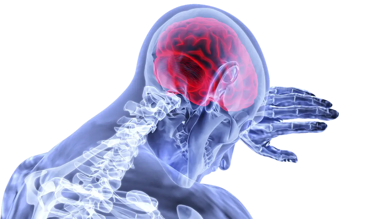 Illustration of Stroke showing brain inflammation