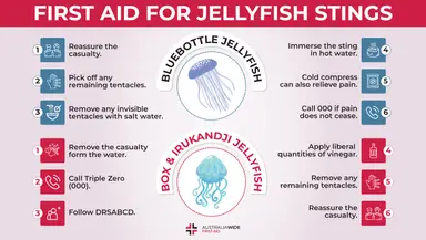 Infographic about First Aid for Jellyfish Stings 