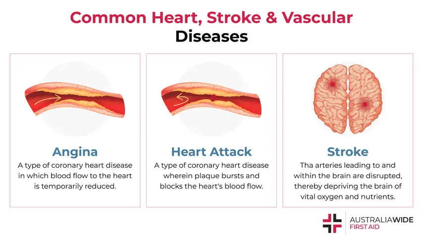 Infographic on Heart, Stroke, and Vascular Diseases
