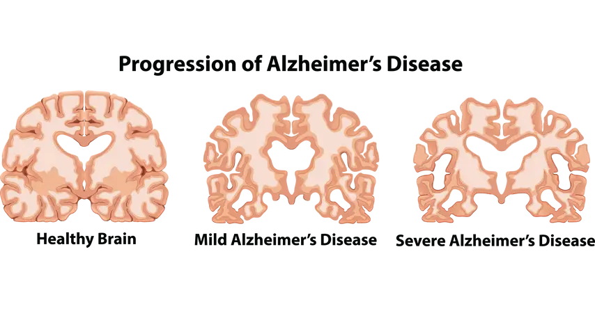 An Anatomy of Human Brain illustration